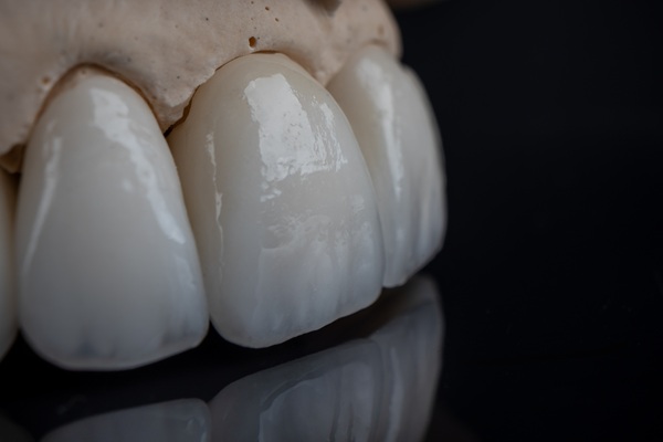 The Steps Of A Dental Crown Restoration