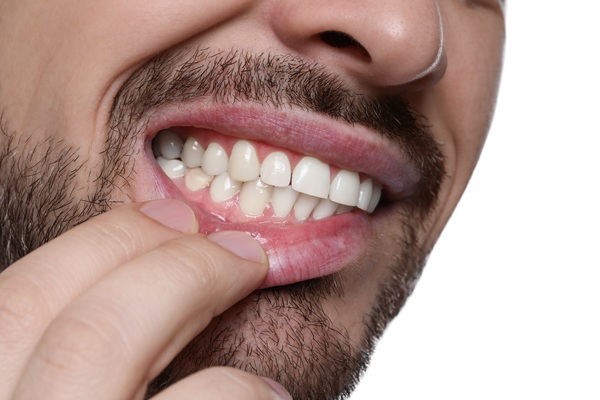 Benefits Of Gum Disease Treatment From A Dentist