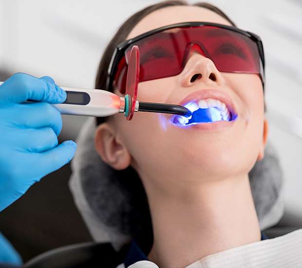 Oakland Professional Teeth Whitening