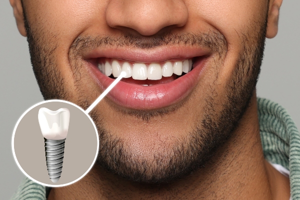 Reasons To See An Implant Dentist After Damaging Dental Implants