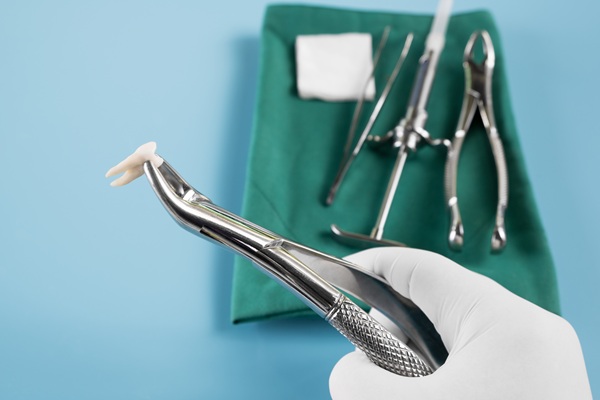 What To Expect Before, During, And After A Tooth Extraction
